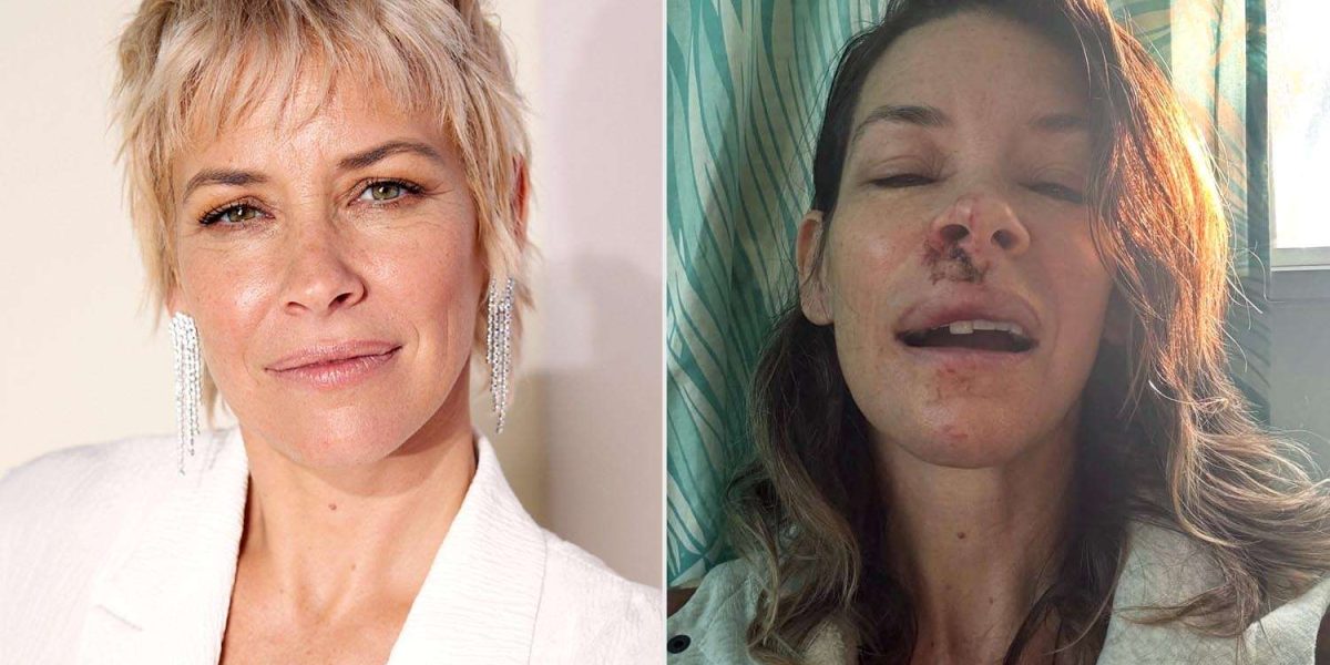 Evangeline-Lilly-D23-after-fall-010326-acf10f236c064bca96aebb2e74bdabf4.jpg - ReactMedia