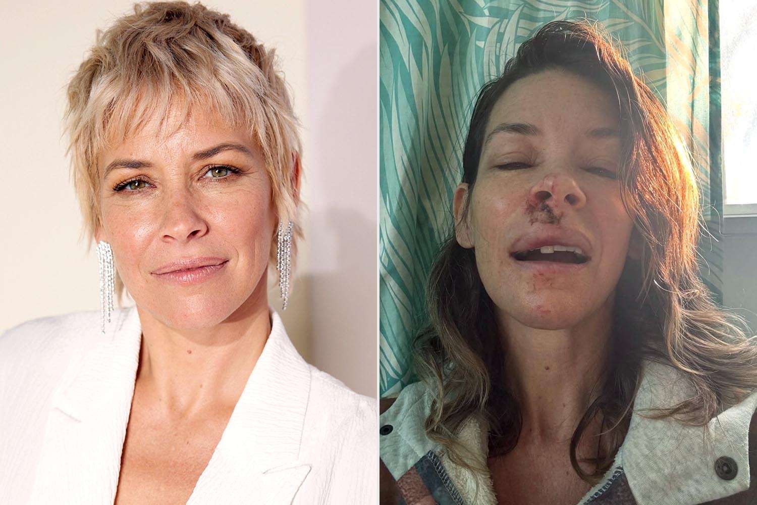 Evangeline Lilly suferă de leziuni cerebrale după un accident grav Actrița Evangeline Lilly a dezvăluit recent că suferă de leziuni cerebrale după un accident care a avut loc în luna mai a anului trecut