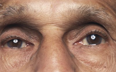 O bacterie prezentă în ochi, asociată cu boala Alzheimer și declinul cognitiv, arată un nou studiu