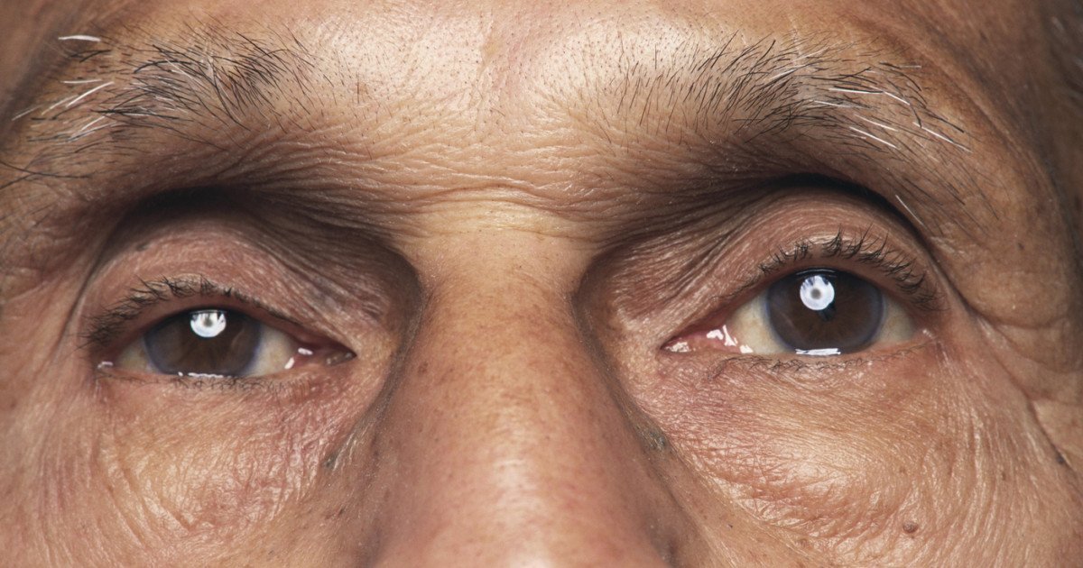 O bacterie oculară, asociată cu boala Alzheimer: Revelații dintr-un studiu recent Prezența bacteriei Chlamydia pneumoniae în retină ar putea fi un indicator semnificativ al declinului cognitiv și al bolii Alzheimer, conform unei cercetări efectuate de specialiști de la Cedars-Sinai Medical Center din Statele Unite