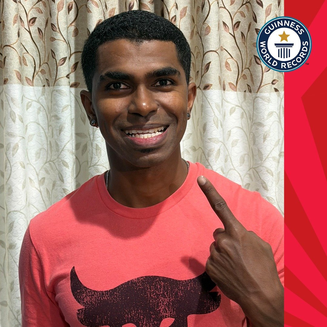 Un bărbat din Malaezia a intrat în Cartea Recordurilor Guinness pentru numărul lor excepțional de dinți, devenind astfel un exemplu de raritate în lumea stomatologiei