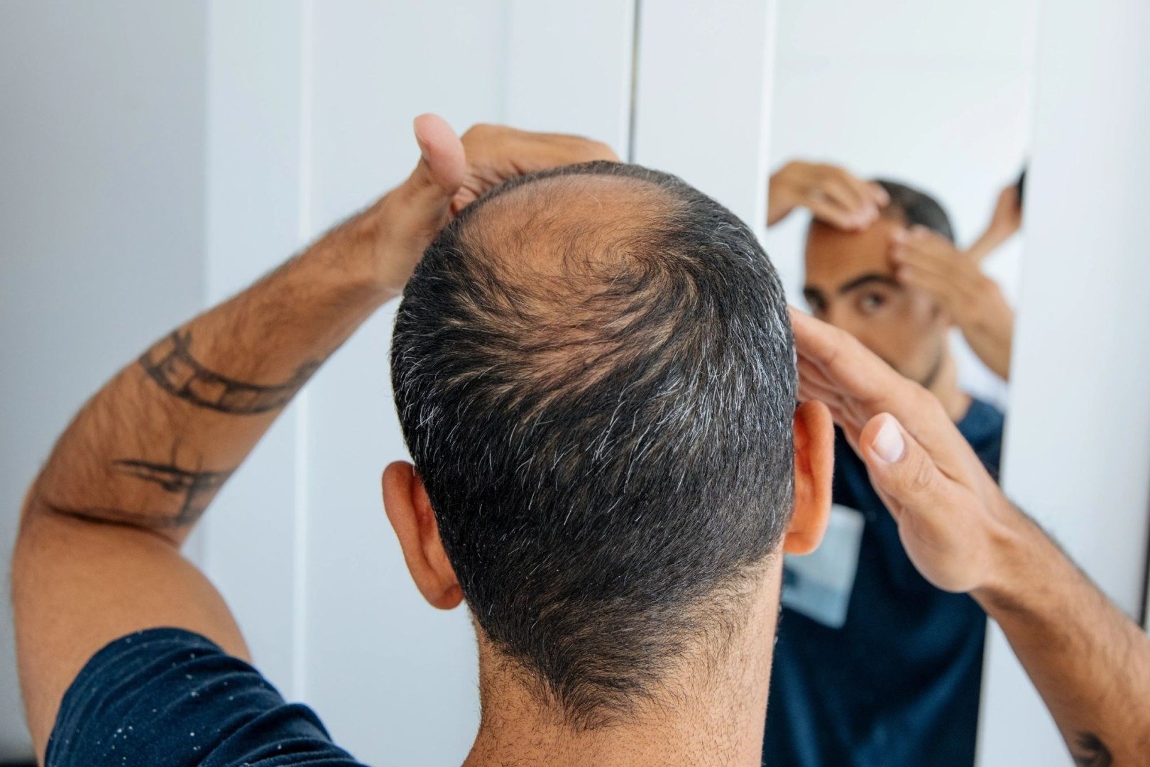 Cercetători au reușit în laborator creșterea foliculilor de păr funcționali pentru tratamentul cheliei