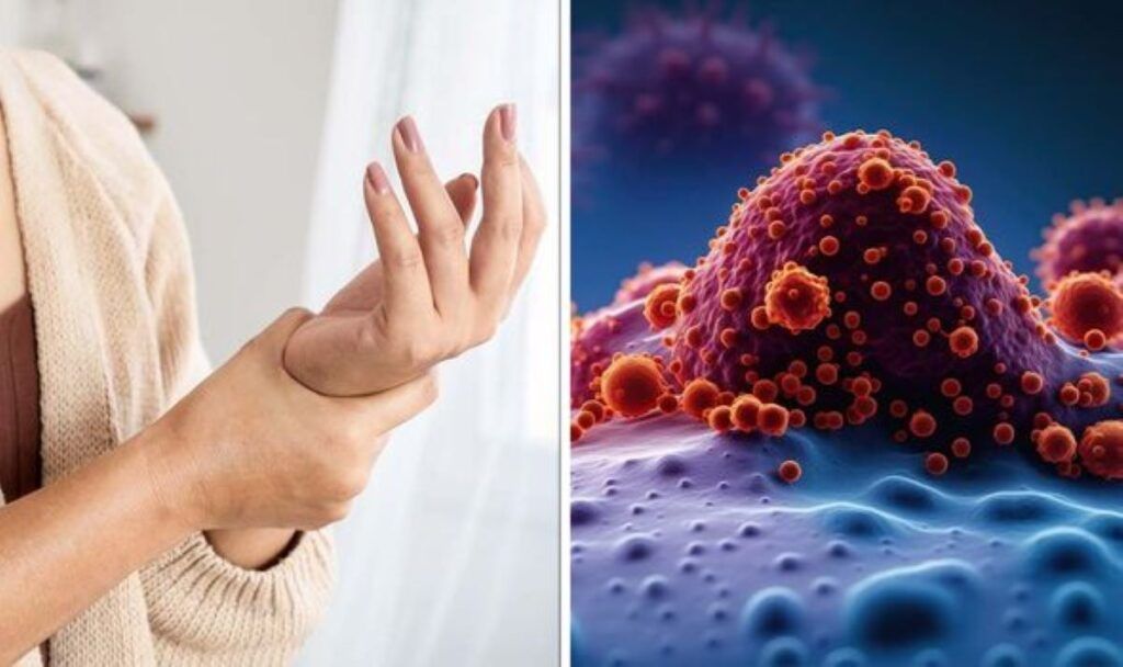 Cele 10 semne timpurii ale cancerului pe care nu trebuie să le ignori Descoperirea precoce a cancerului poate face diferența între o șansă reală de tratament și un diagnostic tardiv, care poate duce la complicații grave