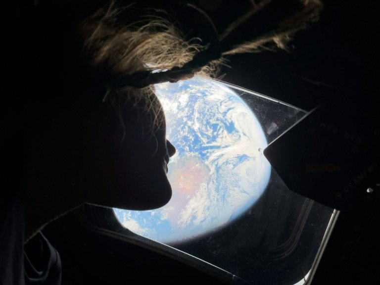 Astronauții Artemis au realizat photosensibilități nemaivăzute anterior de ochii umani, în timpul misiunii lor de aproape două treimi din drum către un zbor de recunoaștere a Lunii, anunță NASA