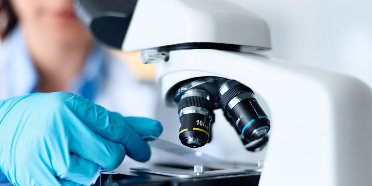 Celule nervoase: Secretul tratamentului pentru Parkinson, dezvăluit