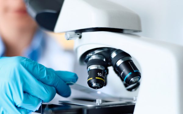 Celule nervoase: Secretul tratamentului pentru Parkinson, dezvăluit