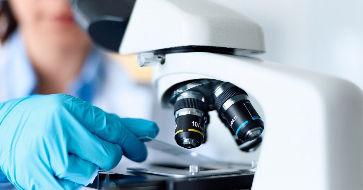 Celule nervoase: Secretul tratamentului pentru Parkinson, dezvăluit