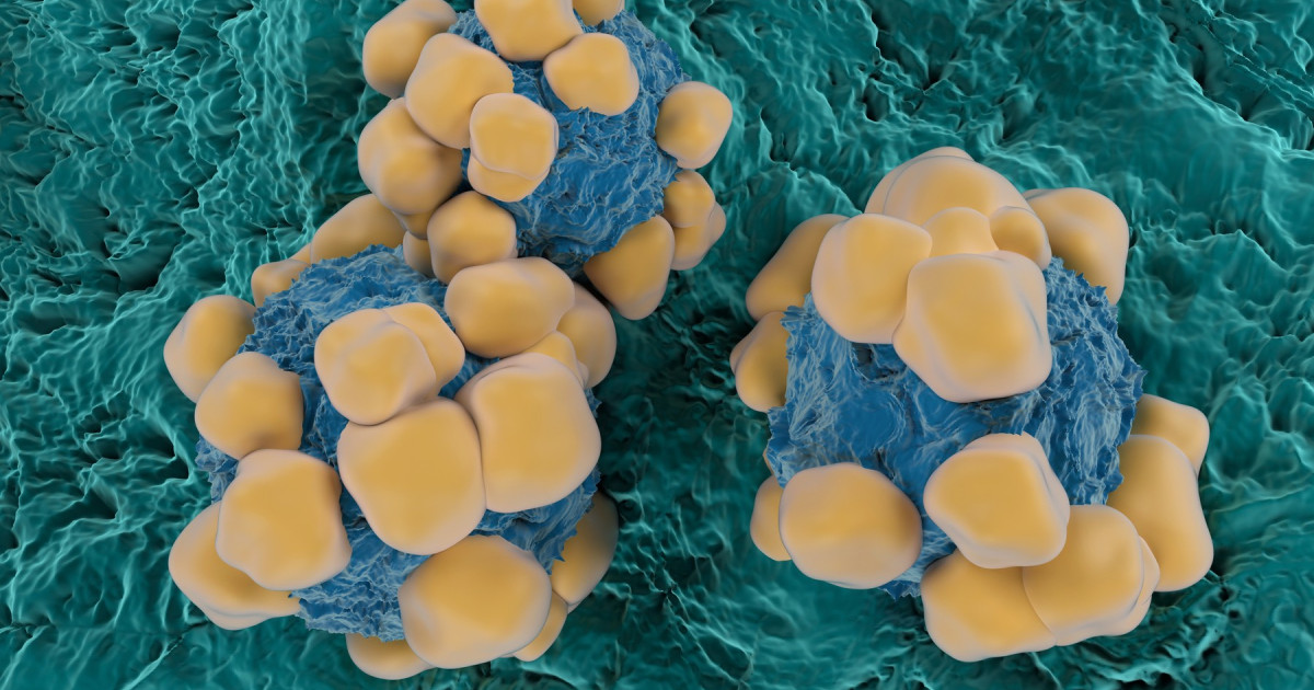 Oamenii de știință au dezvoltat senzori ultrafaini, de grosimea unui fir de păr, care pot detecta mai mulți biomarkeri ai cancerului simultan, o descoperire menită să schimbe modul în care se face diagnosticarea și monitorizarea bolilor oncologice