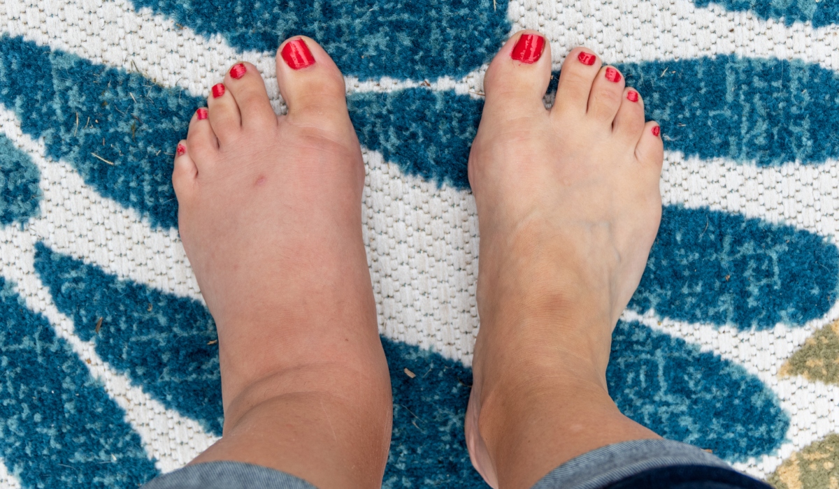 Picioarele pot ascunde semne de avertizare ale unor afecțiuni grave pentru sănătate, chiar dacă la o primă vedere par perfect normale