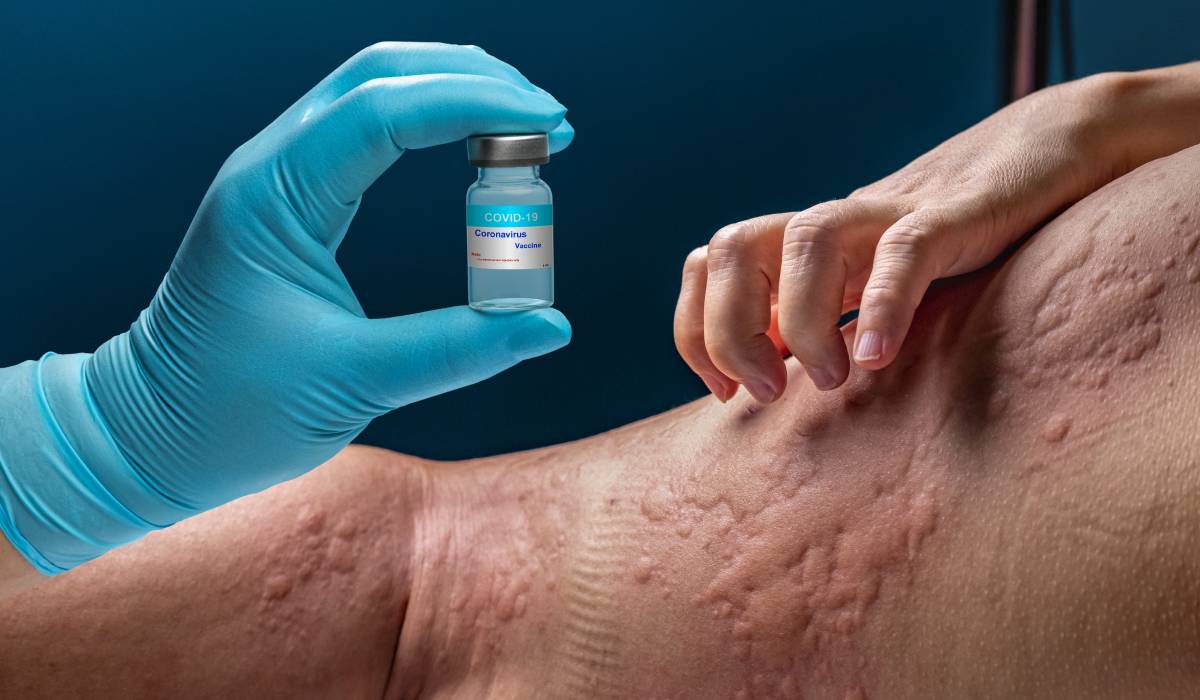 Femeie diagnosticată cu peste 40 de alergii după o lungă căutare a cauzei problemelor de sănătate O tânără din România, care de mai mulți ani a trăit cu o serie de simptome inexplicabile, a descoperit recent că suferă de peste 40 de alergii diferite