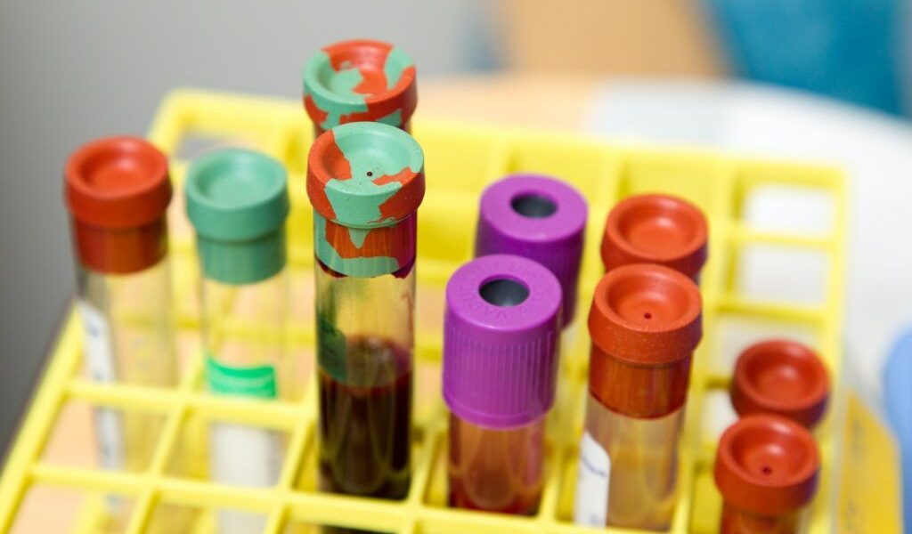Cât costă analizele în 2026 pentru cine NU are asigurare medicală în România?