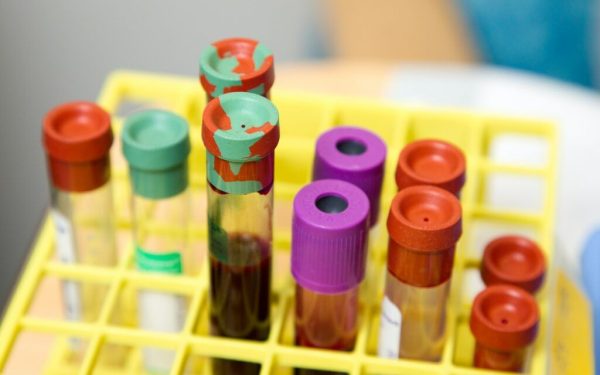 Cât costă analizele în 2026 pentru cine NU are asigurare medicală în România?