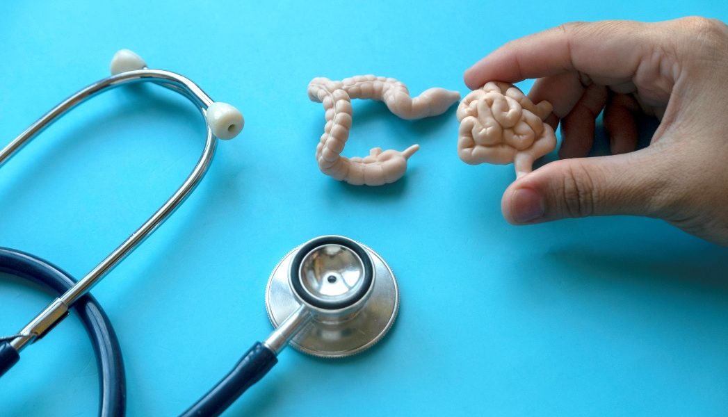 Cancerul de colon lovește tinerii: Fenomenul global devine alarmant, ce se întâmplă?