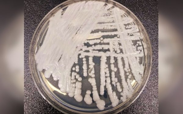 Candida Auris, coșmarul spitalelor, endemică și în România. Sub control