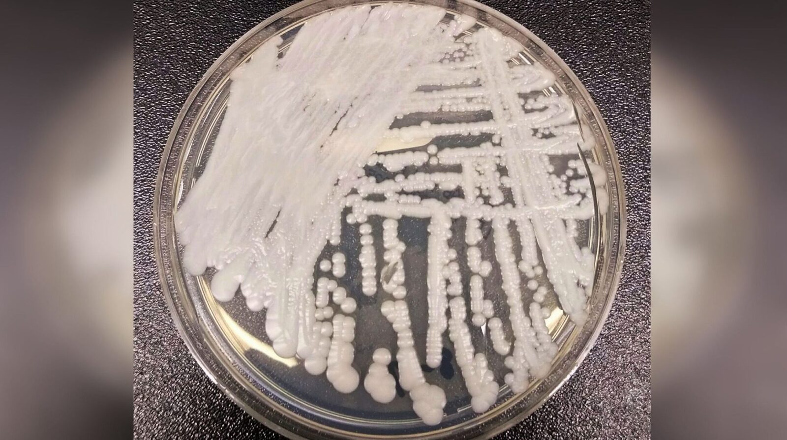 Candida Auris, coșmarul spitalelor, endemică și în România. Sub control