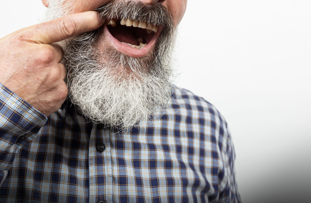 Tratament rapid pentru dinți lipsă, soluție pentru pacienții cu dantură sever compromisă Pentru persoanele care au pierdut mai mulți dinți sau au o dantură grav afectată, a găsi o soluție rapidă și durabilă devine o prioritate