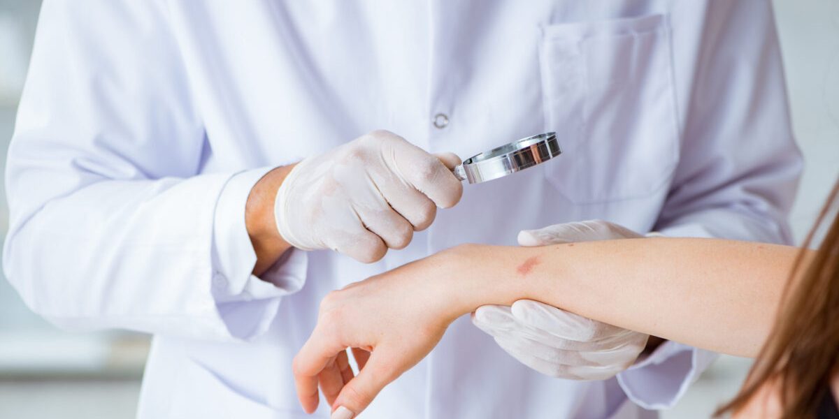 Ectima: Cauze, simptome și tratamente eficiente