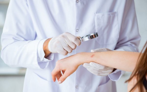 Ectima: Cauze, simptome și tratamente eficiente