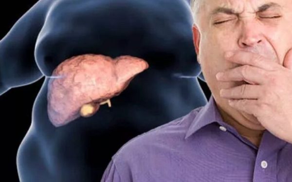 Boala ficatului gras, tratată fără dietă. Noua speranță a cercetătorilor