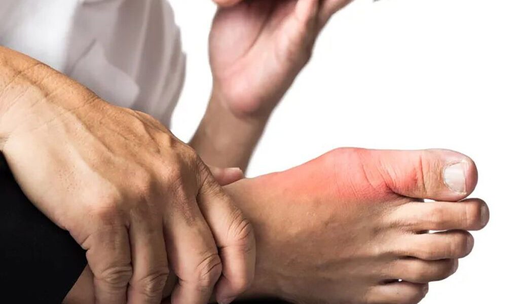 Vitamina-minune: Scade acidul uric și alină durerile de gută