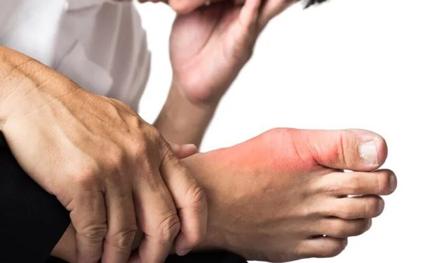 Vitamina-minune: Scade acidul uric și alină durerile de gută