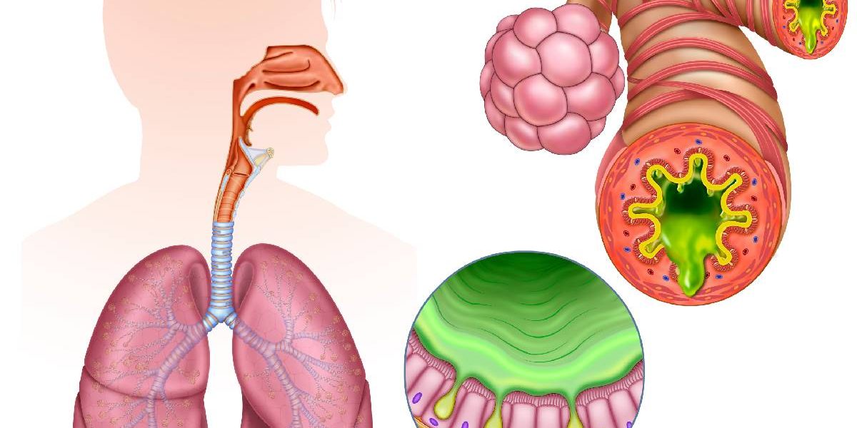 Inflamția cronică, inamicul ascuns: Atacă sănătatea modernă, avertizează specialiștii