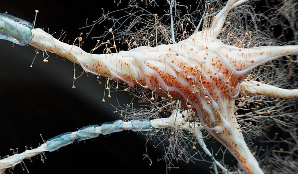 Cercetătorii au descoperit o legătură surprinzătoare între inflamația intestinală și scleroza multiplă (SM), o boală autoimună gravă