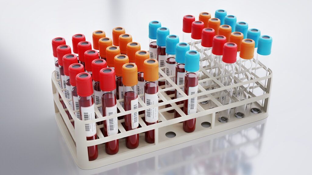 Analiza sângelui: Noul test care depășește colesterolul, depistează infarctul