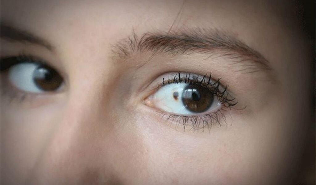 Cancerul se ascunde în ochi: 11 semnale subtile de alarmă. Află cum le identifici