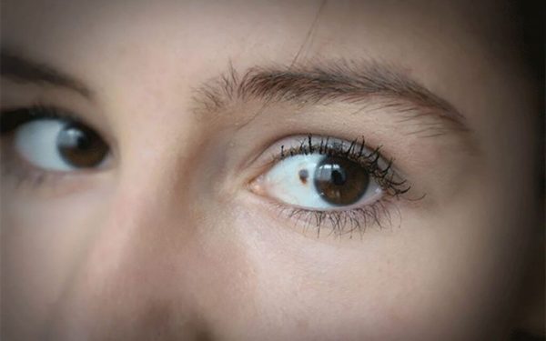 Cancerul se ascunde în ochi: 11 semnale subtile de alarmă. Află cum le identifici