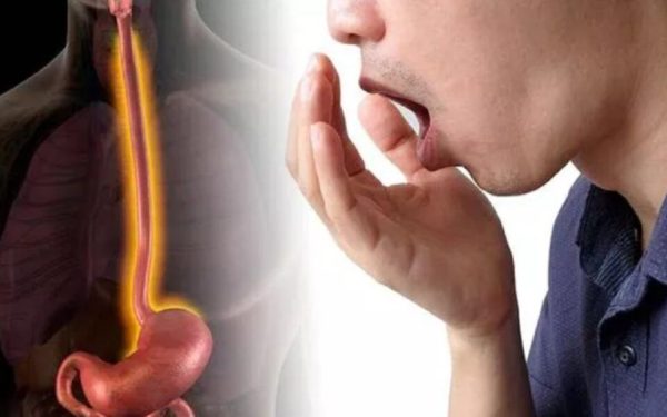 Jenantul simptom al sindromului de colon iritabil ignorat: Nu e despre digestie
