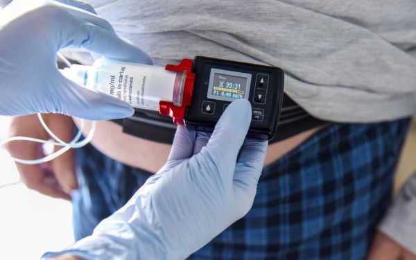 Cum ajută tehnologia bolnavii de Parkinson: Detalii despre tratamente