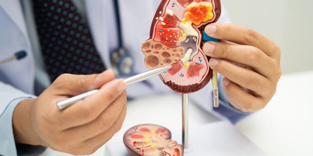 Acid Uric și creatinină: ce secrete ascund analizele RENALE?