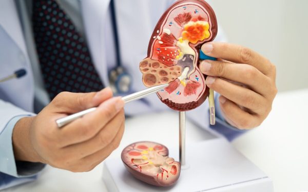 Acid Uric și creatinină: ce secrete ascund analizele RENALE?