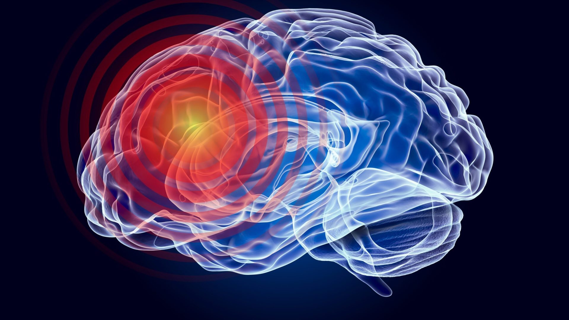 O echipă de cercetători a identificat o tulburare de dezvoltare neurologică, necunoscută până acum, cu o componentă genetică