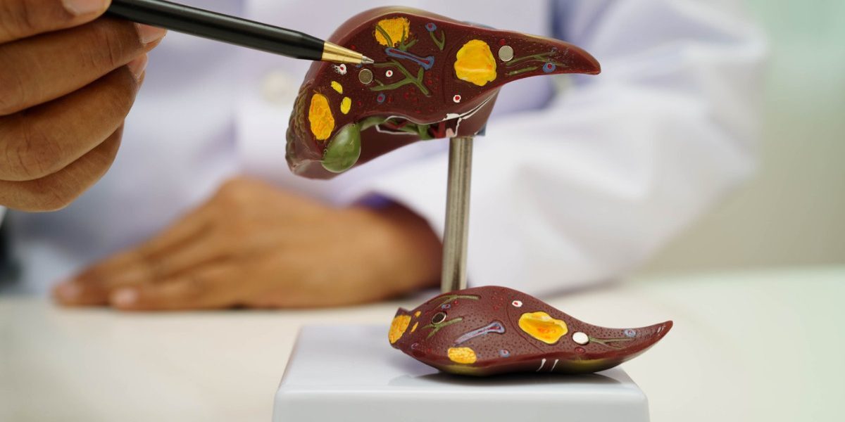Boala ficatului gras: Atentie la acest „simptom”! Ce spun medicii din România