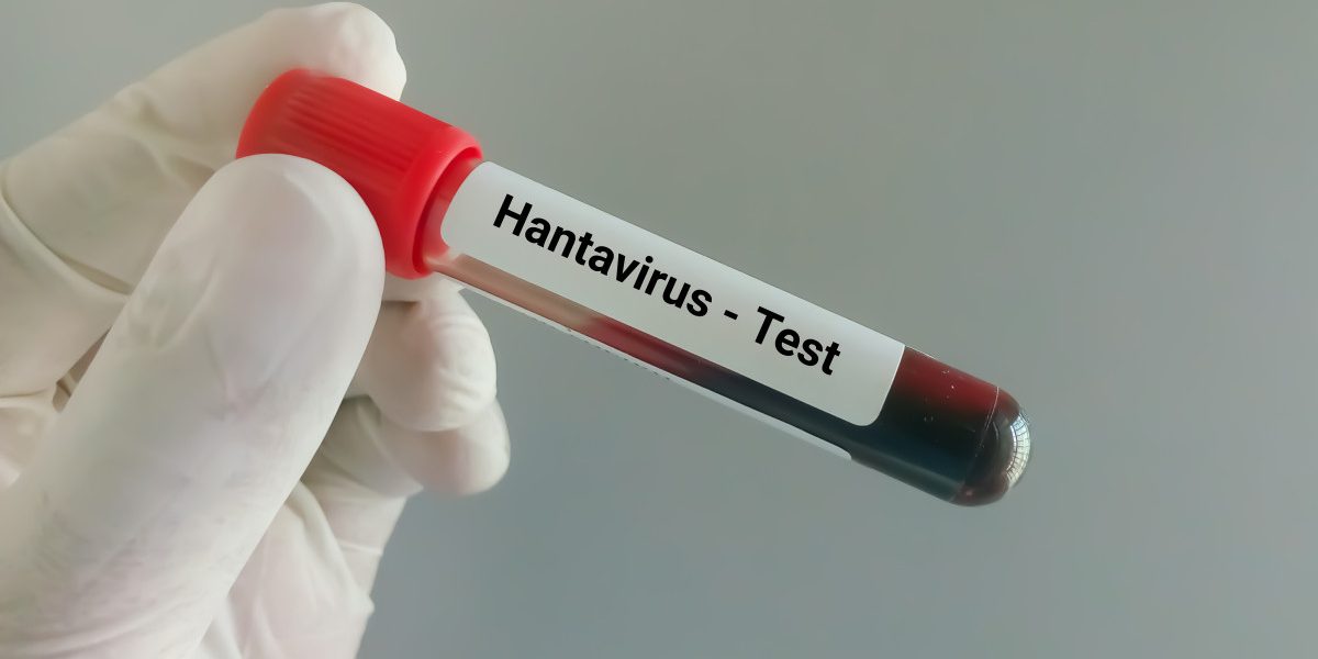 Hantavirus la Arad: Ancheta epidemiologică, ce spun medicii despre virus