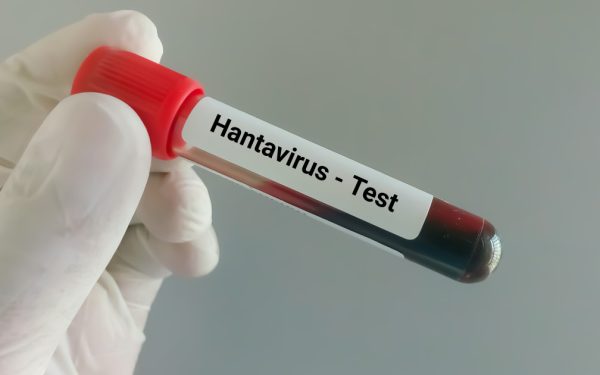 Hantavirus la Arad: Ancheta epidemiologică, ce spun medicii despre virus
