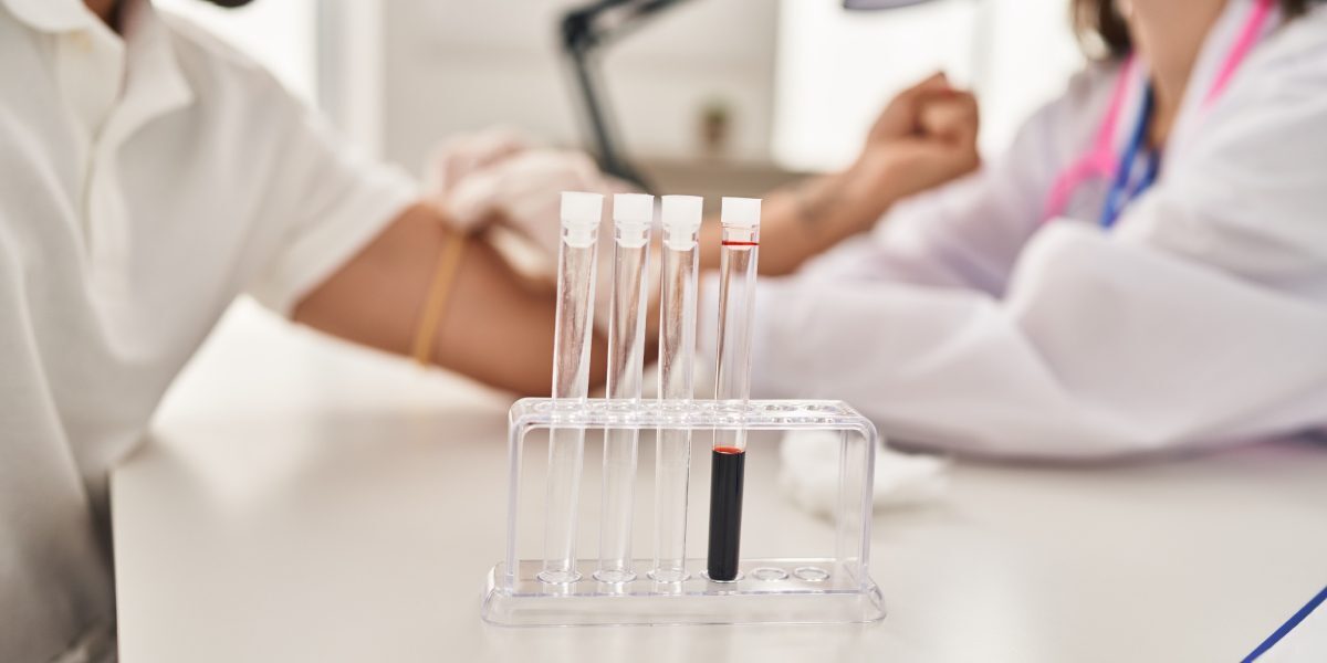 Analize sânge: 5 testele obligatorii înainte de sală