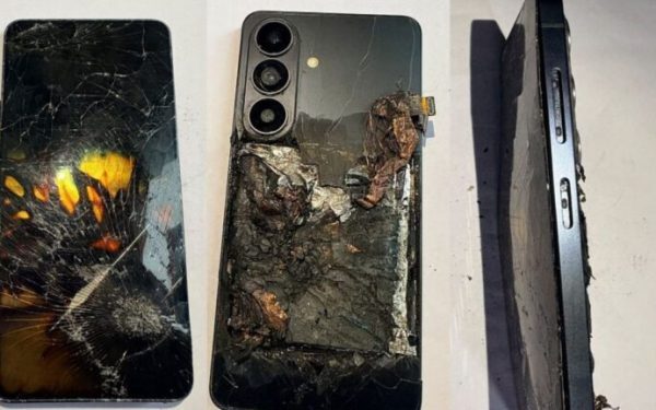 Telefon Samsung a Explodat în Buzunar. Bărbat Ars Grav