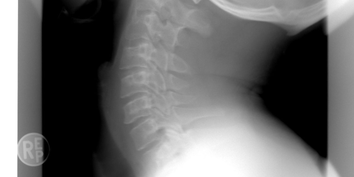 Spitalul Bihor: Inteligența Artificială ajută radiologii la Urgențe