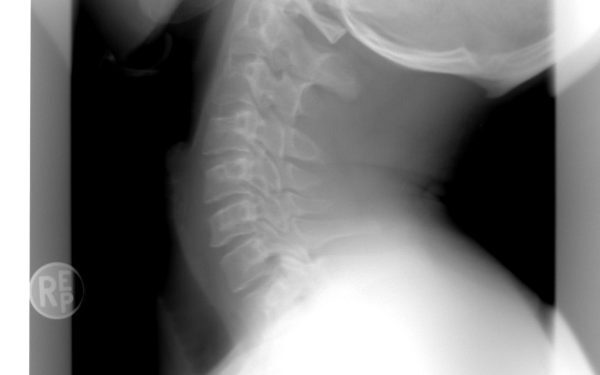 Spitalul Bihor: Inteligența Artificială ajută radiologii la Urgențe