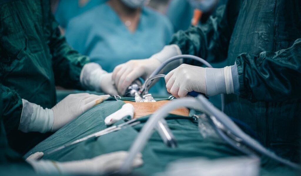 Ce e colecistomia: operația celebrității și simptomele ei